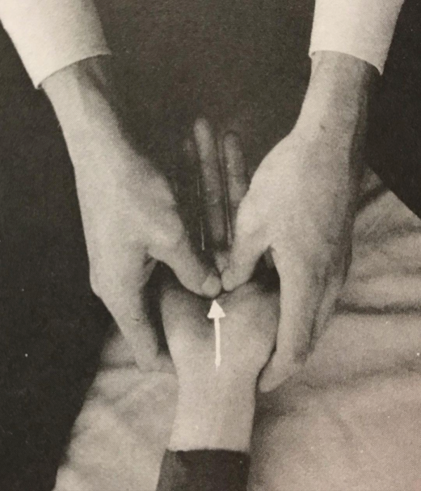 Acupuncture needle placement on hands